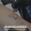 A Sua Tatuagem Já Não Faz Sentido? Como Iniciar um Novo Capítulo